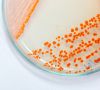 Petrischale mit orangenen Bakterienkolonien